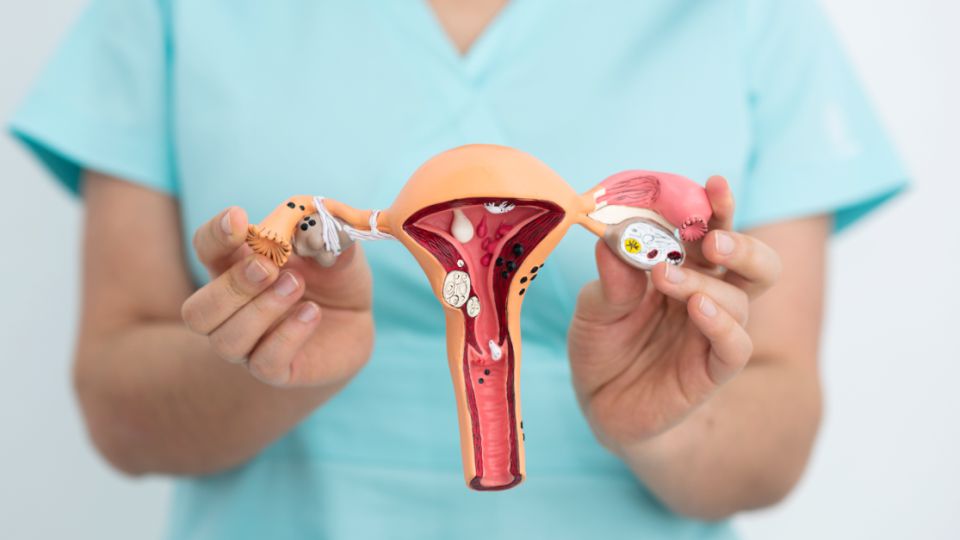 Inseminación intrauterina